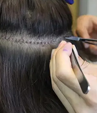 拆线