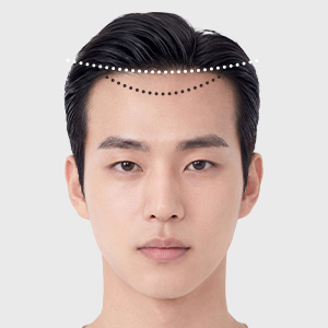美人尖