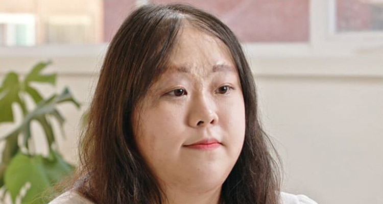 毛杰琳的女性疤痕毛发移植